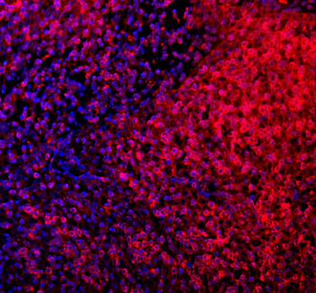 CD80 Rabbit Polyclonal Antibody