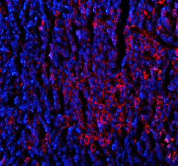 CD80 Rabbit Polyclonal Antibody