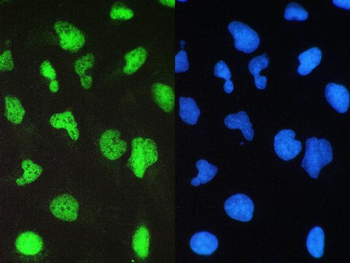 BRG1/SMARCA4 Rabbit Polyclonal Antibody