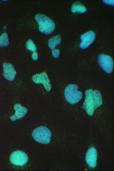 BRG1/SMARCA4 Rabbit Polyclonal Antibody
