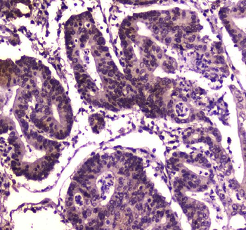 BRG1/SMARCA4 Rabbit Polyclonal Antibody