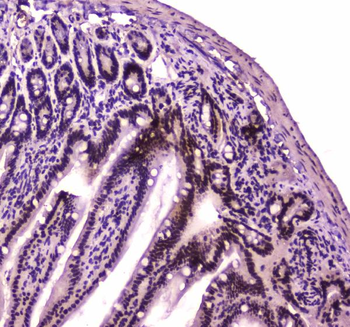 BRG1/SMARCA4 Rabbit Polyclonal Antibody