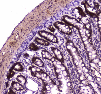 BRG1/SMARCA4 Rabbit Polyclonal Antibody