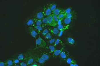MVP Rabbit Polyclonal Antibody