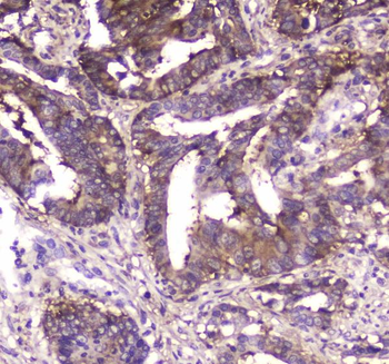 MVP Rabbit Polyclonal Antibody
