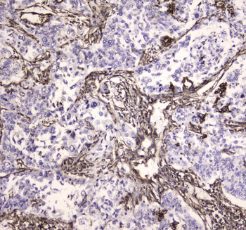 MVP Rabbit Polyclonal Antibody