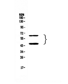 TIM 3/HAVCR2 Rabbit Polyclonal Antibody