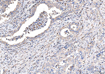 CD163 Rabbit Polyclonal Antibody