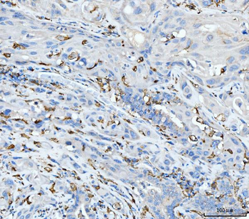 CD163 Rabbit Polyclonal Antibody