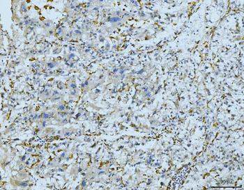CD163 Rabbit Polyclonal Antibody
