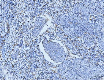 CD163 Rabbit Polyclonal Antibody