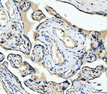 CD163 Rabbit Polyclonal Antibody