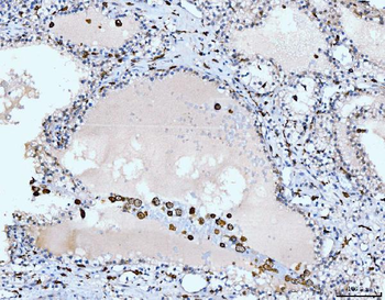 CD163 Rabbit Polyclonal Antibody