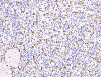 CD163 Rabbit Polyclonal Antibody