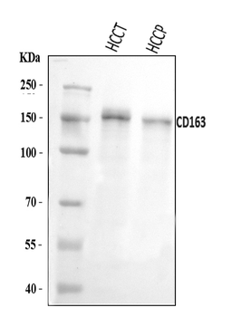 CD163 Rabbit Polyclonal Antibody