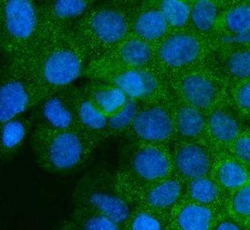 Mannose 6 Phosphate Receptor/IGF2R Rabbit Polyclonal Antibody