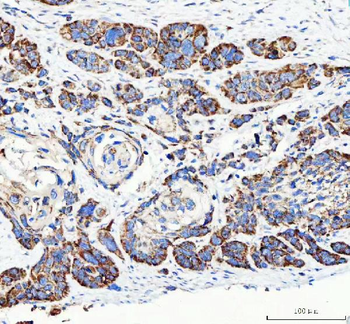 Mannose 6 Phosphate Receptor/IGF2R Rabbit Polyclonal Antibody