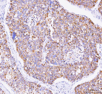 Mannose 6 Phosphate Receptor/IGF2R Rabbit Polyclonal Antibody