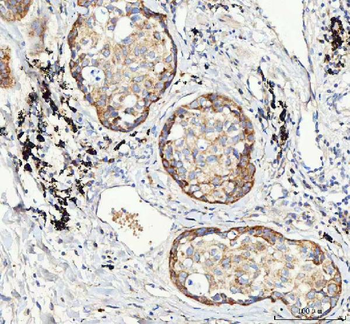 Mannose 6 Phosphate Receptor/IGF2R Rabbit Polyclonal Antibody