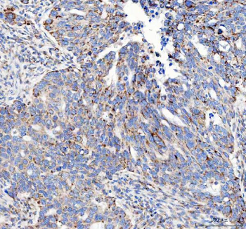 Mannose 6 Phosphate Receptor/IGF2R Rabbit Polyclonal Antibody