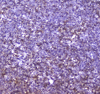 CBFb Rabbit Polyclonal Antibody