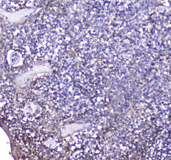 BCMA/TNFRSF17 Rabbit Polyclonal Antibody