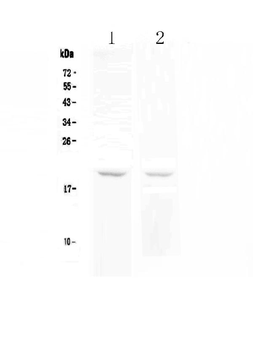 BCMA/TNFRSF17 Rabbit Polyclonal Antibody