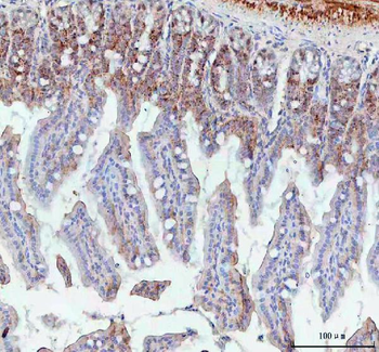 BCMA/Tnfrsf17 Rabbit Polyclonal Antibody