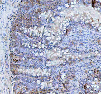 BCMA/Tnfrsf17 Rabbit Polyclonal Antibody