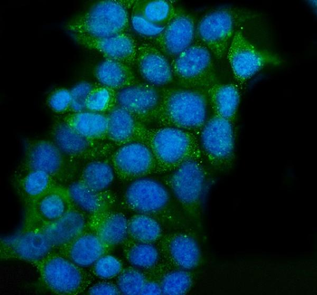 CLPP Rabbit Polyclonal Antibody