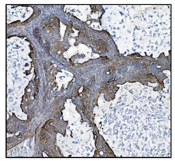 CLPP Rabbit Polyclonal Antibody