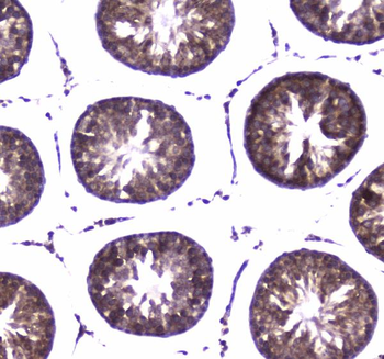 WWOX Rabbit Polyclonal Antibody
