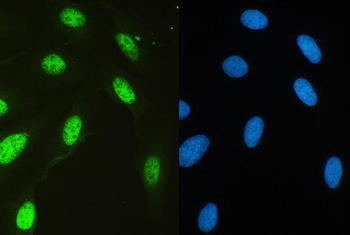 HAUSP/USP7 Rabbit Polyclonal Antibody