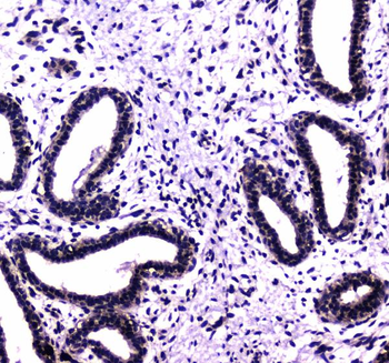 HAUSP/USP7 Rabbit Polyclonal Antibody