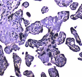 HAUSP/USP7 Rabbit Polyclonal Antibody