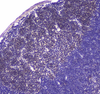 HAUSP/USP7 Rabbit Polyclonal Antibody
