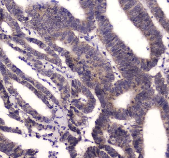 BRD7 Rabbit Polyclonal Antibody