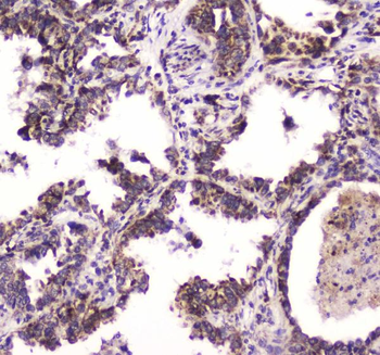 BRD7 Rabbit Polyclonal Antibody