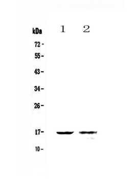 Galectin 10/CLC Rabbit Polyclonal Antibody