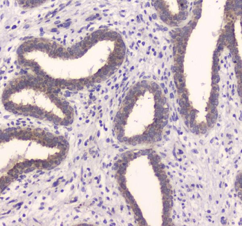 Insulin degrading enzyme/IDE Rabbit Polyclonal Antibody
