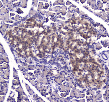 Insulin degrading enzyme/IDE Rabbit Polyclonal Antibody