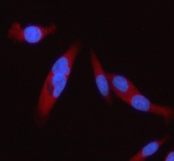 STAT2 Rabbit Polyclonal Antibody