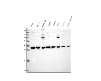 VAPB Rabbit Polyclonal Antibody