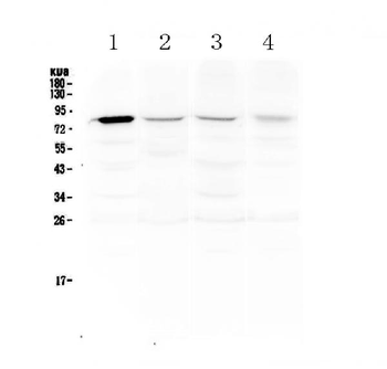 DNA Polymerase iota/POLI Rabbit Polyclonal Antibody