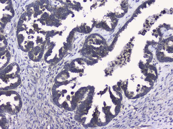 RALBP1 Rabbit Polyclonal Antibody