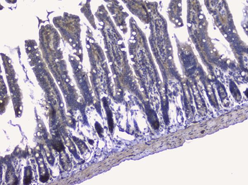 RALBP1 Rabbit Polyclonal Antibody