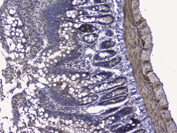 RALBP1 Rabbit Polyclonal Antibody