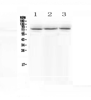 epithelial Sodium Channel alpha/SCNN1A Rabbit Polyclonal Antibody