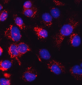 Glutathione Reductase/GSR Rabbit Polyclonal Antibody