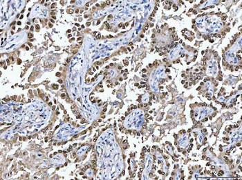 Glutathione Reductase/GSR Rabbit Polyclonal Antibody